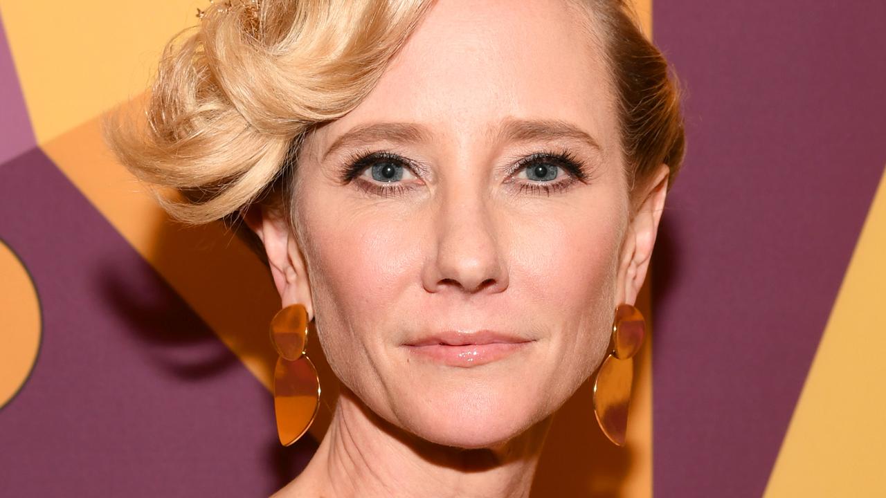 Anne Heche, Ellen DeGeneres' ex-girlfriend, severely burned after LA crash