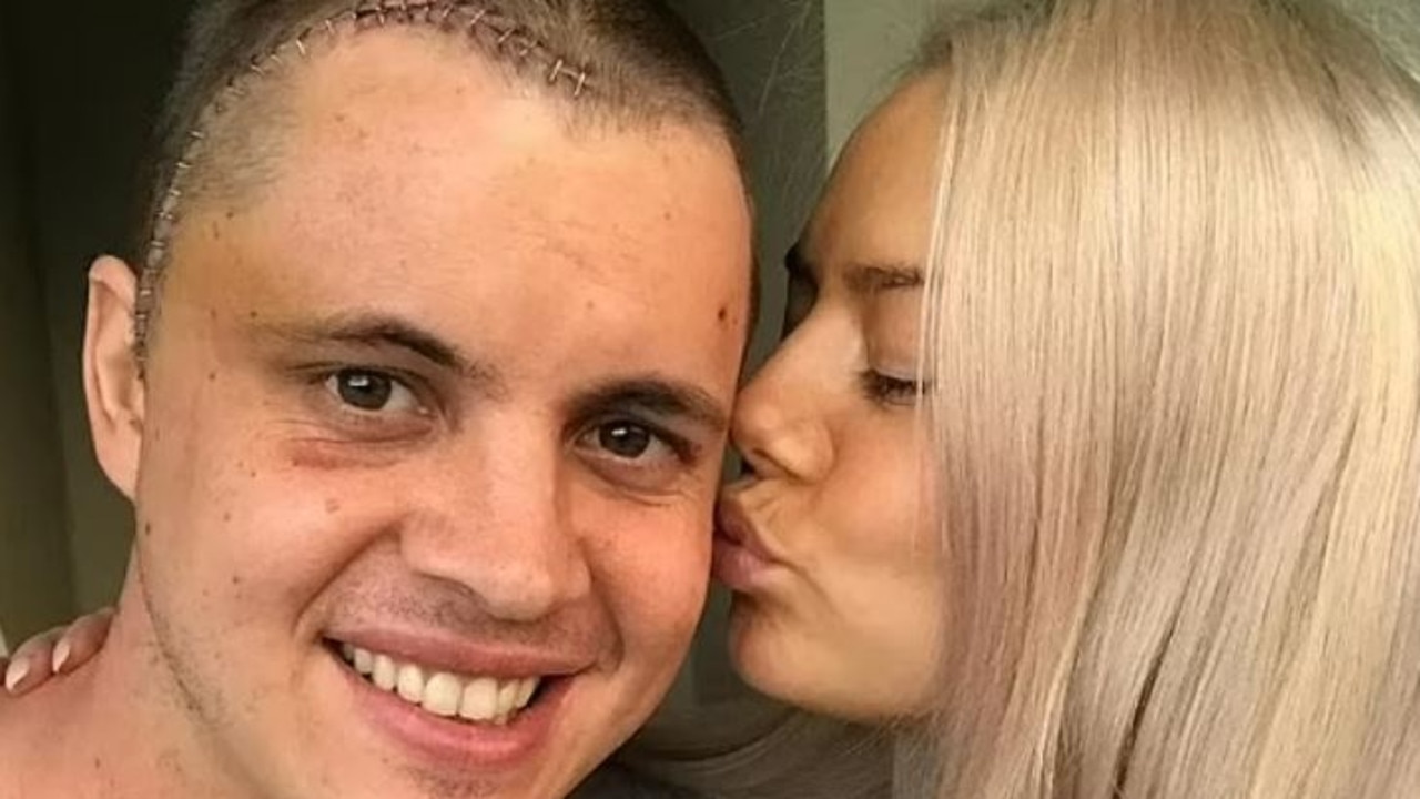 Johnny Ruffo shares update on his brain cancer battle