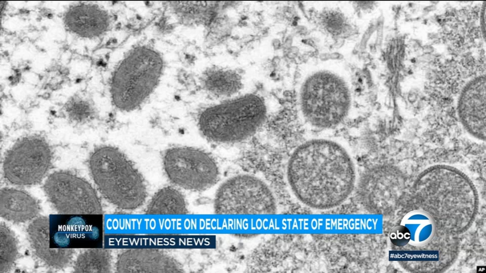 LA County Board of Supervisors proclaims local emergency for monkeypox amid rising cases