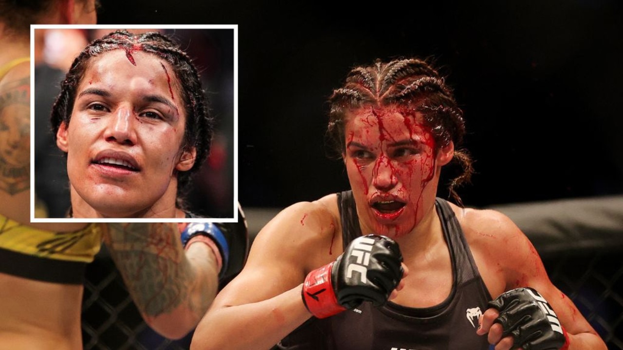 UFC 2022: Julianna Pena plastic surgery after defeating Amanda Nunes, photos, video