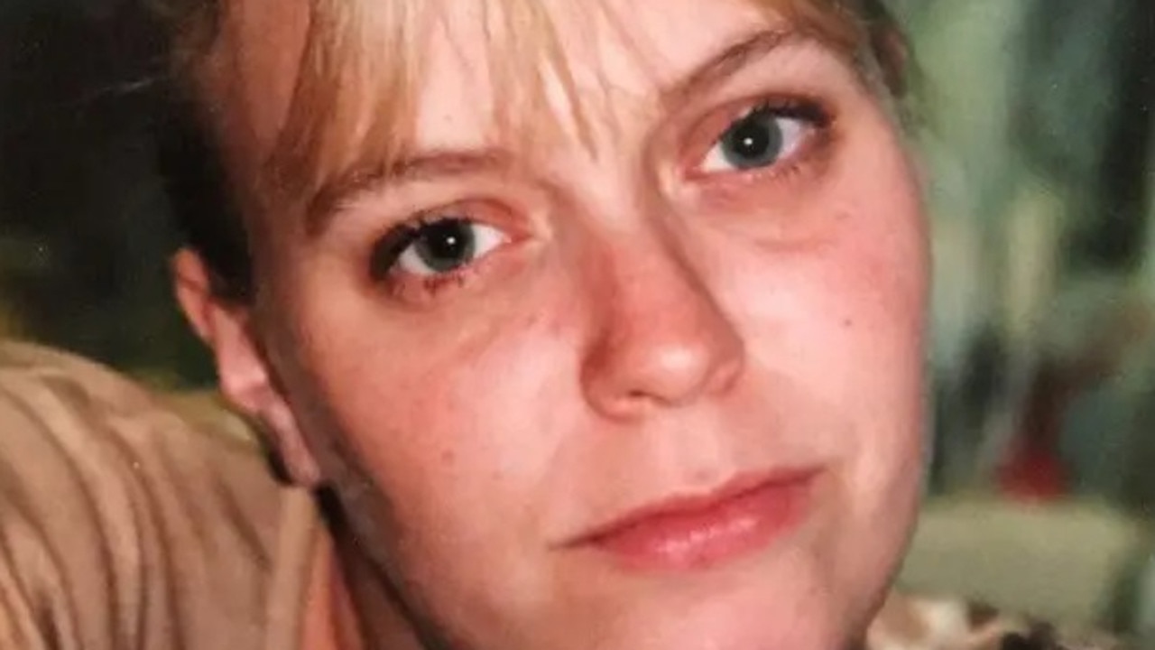 UK woman dies after face collapsed from disease Wegener's granulomatosis